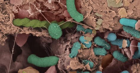 Soil Microbiota