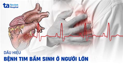 Bệnh tim bẩm sinh ở người lớn Dấu hiệu nguyên nhân và chẩn đoán