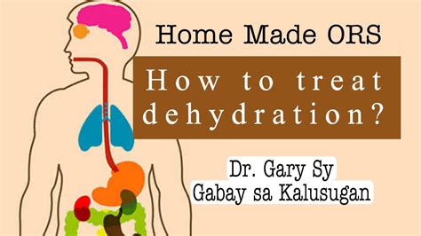 How To Treat Dehydration Home Made Ors Dr Gary Sy Youtube