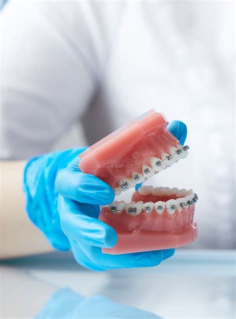 Doctor Orthodontist Showing Model Of Human Jaw With Wire Braces