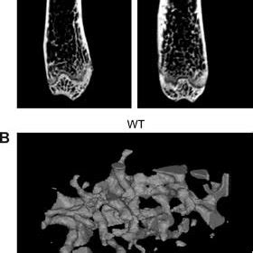 Gpr Ko Mice Have Increased Trabecular Bone Volume And Connectivity In