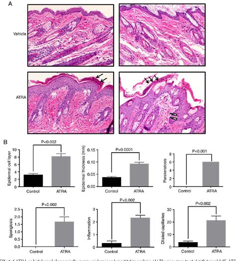 Figure From All Trans Retinoic Acid Alters The Expression Of The