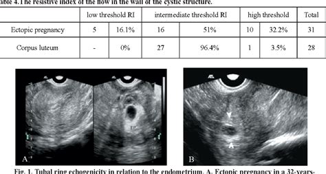 Corpus Luteum Ultrasound