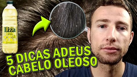 CABELO OLEOSO 5 Dicas ESSENCIAIS Para Lidar O CABELO OLEOSO E Ver