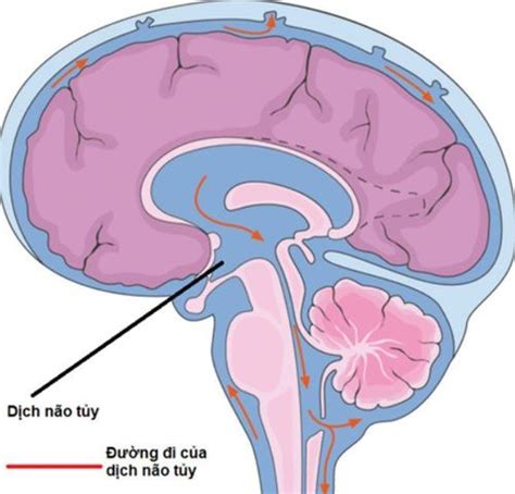 Meningeal syndrome: Signs, causes and treatment | Vinmec