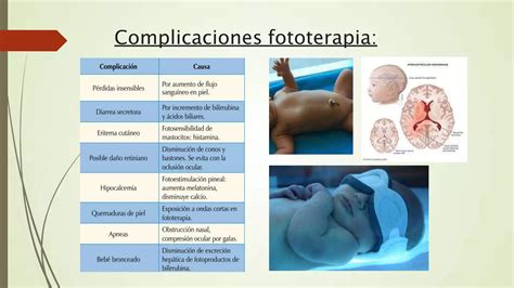 Ictericia Neonatal Pptx