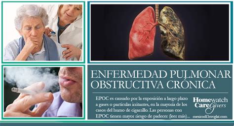 Epoc Enfermedad Pulmonar Obstructiva Cr Nica