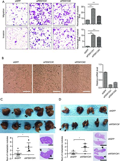 Fem1c Knockdown Promoted Metastasis In Crc A After Transfection With