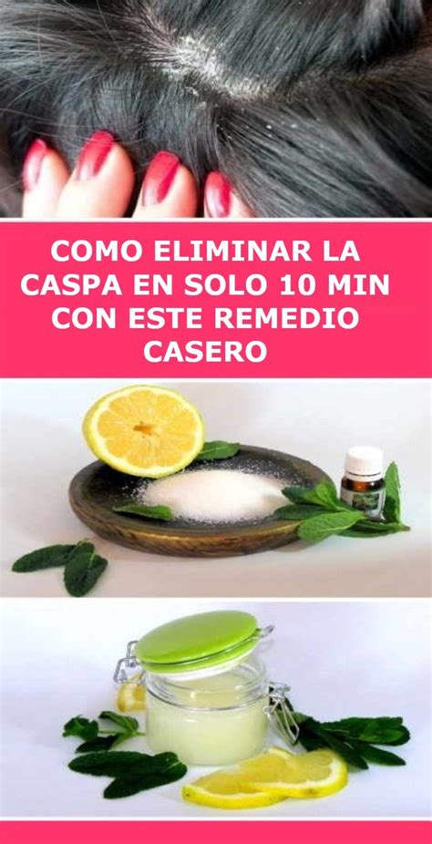 10 Remedios Caseros Para Deshacerte De La Caspa De Manera Natural Para