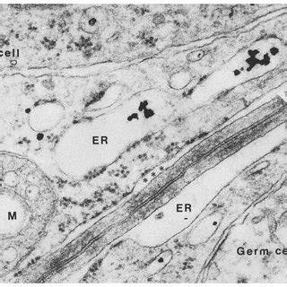 Electron Micrograph Of A Tight Junction Between Adjoining Sertoli Cells