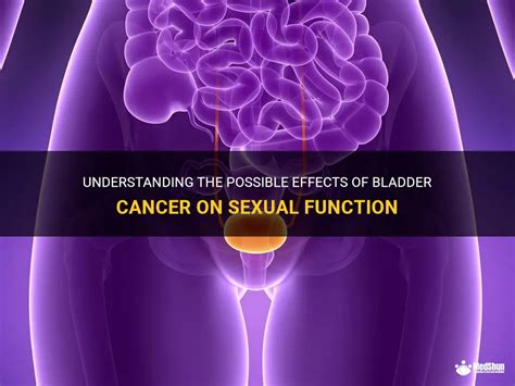 Understanding The Possible Effects Of Bladder Cancer On Sexual Function Medshun