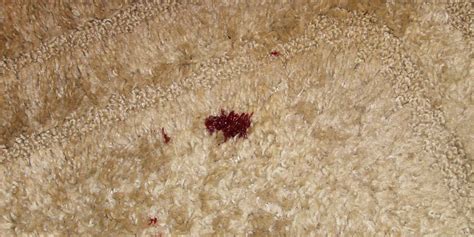 Best Way To Remove Dried Blood Stains From Carpet