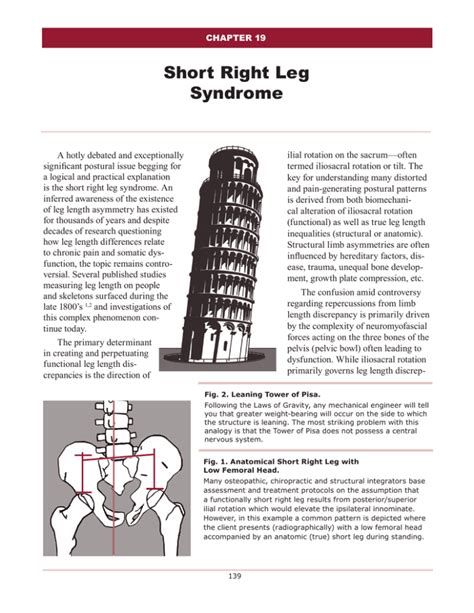 Short Right Leg Syndrome