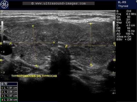 A Gallery Of High Resolution Ultrasound Color Doppler And 3d Images