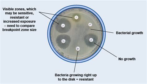 How To Measure Zones Of Inhibition