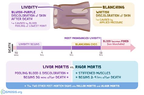 Livor Mortis: What Is It, Occurrence, and More | Osmosis