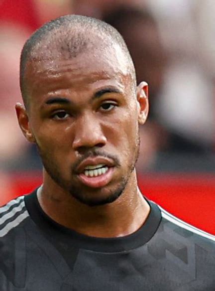 Gabriel Magalhães Hair Transplant Everything You Need To Know