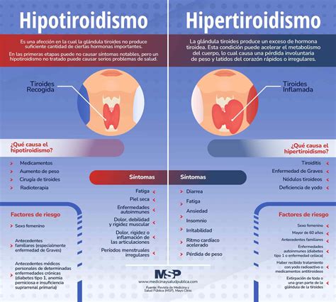 Cuadro Comparativo Entre Hipertiroidismo E Hipotiroidismo Hot Sex