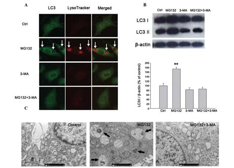 Proteasome Inhibitor Induced Autophagy In Pc12 Cells Overexpressing