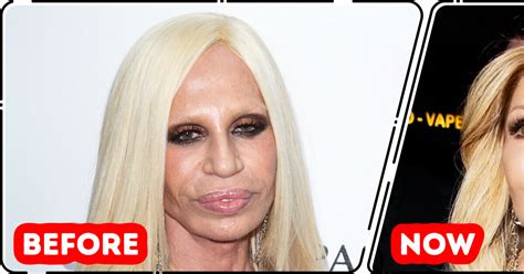 “This Is the Best She Has Looked in Decades!” New Look of Donatella