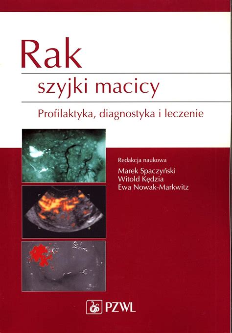 Rak Szyjki Macicy Profilaktyka Diagnostyka I Leczenie Spaczy Ski