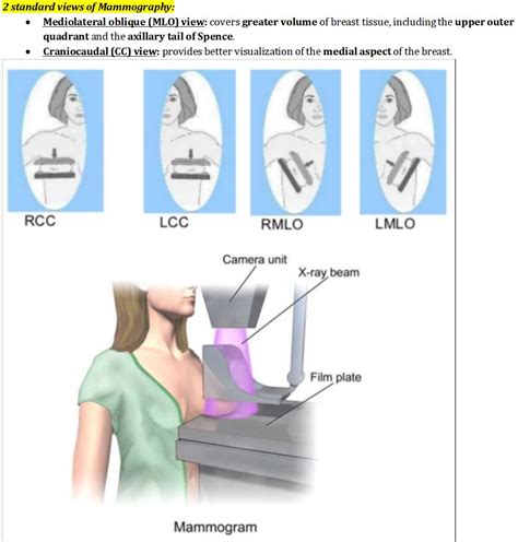 Standard views of Mammography.