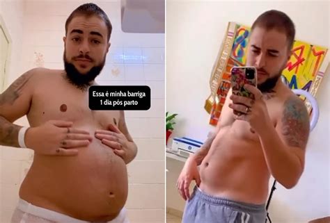 Pai trans influencer é alvo de transfobia ao mostrar barriga pós parto