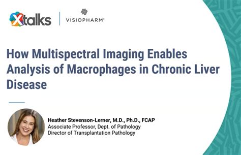 How Multispectral Imaging Enables Analysis Of Macrophages In Chronic