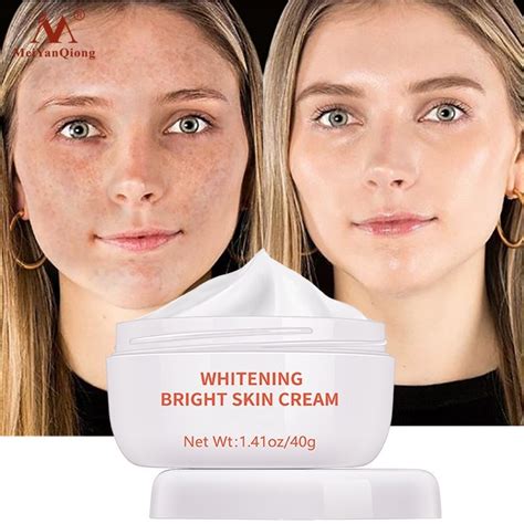 Powerful Whitening Freckle Cream Removes Acne Spots Melanin Dark Spots Juhi