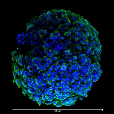 Watch As Researchers Create Beating, 3D Printed Heart Organoid - 3DPrint.com | The Voice of 3D ...