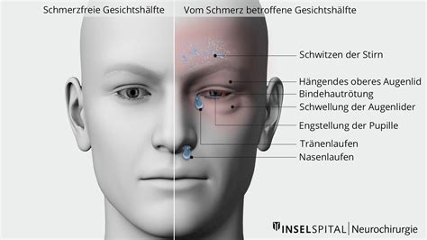 Erkennen Sie Kopfschmerzen Unser Ratgeber Add Wiki