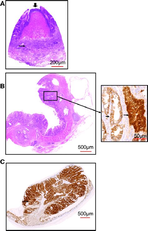 Inflammation Overcomes The Tumour Resistance In The Apc Min Mbd2