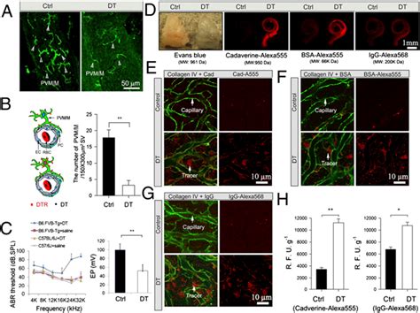 Figure 1 from Perivascular-resident macrophage-like melanocytes in the inner ear are essential ...