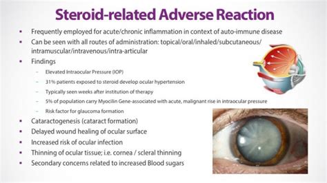 Lupus and the eye