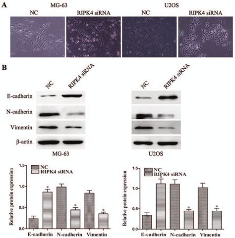 Silencing Of Ripk4 Suppresses Emt In Os Cells A The Morphological Download Scientific