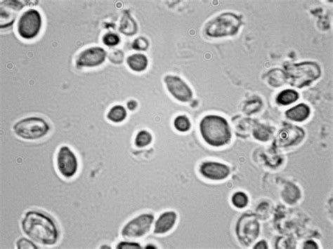 Kluyveromyces Marxianus Viticulture And Enology