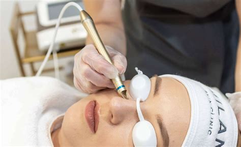 Facial Thread Vein Removal Reading Milan Skin Clinic