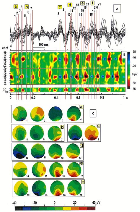 Frontiers The Eeg Split Alpha Peak Phenomenological Origins And