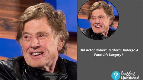 Did Actor Robert Redford Undergo A Face Lift Surgery Before And After