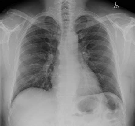 Radiology Quiz 153502 Radiopaedia Org