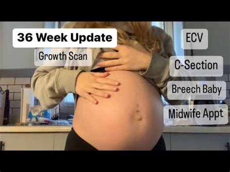 36 Week Pregnancy Update Breech Baby Growth Scan C Section YouTube