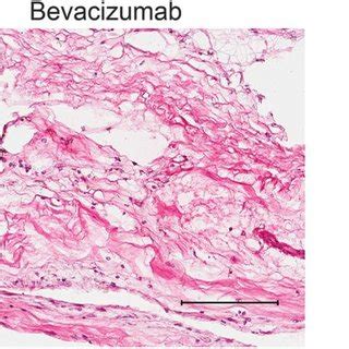 A Hematoxylin And Eosin Stained Histological Sections Demonstrated The