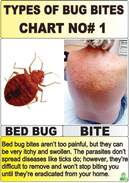 12 Most Harmful Types Of Bug Bites Chart Explained Y L P C