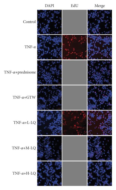 Lq Action On Rasf Cell Proliferation Was Detected Using Edu Assay And