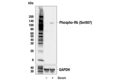 Phospho Rb Ser807 E8x7b Rabbit Mab Cell Signaling Technology