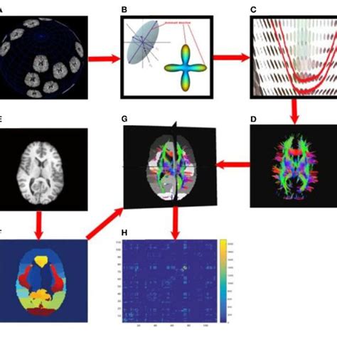 Flowchart To Compute Structural Brain Networks A Diffusion Mri