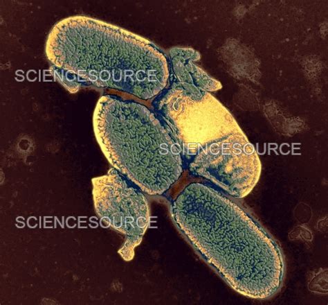 Photograph Shigella Dysenteriae Science Source Images