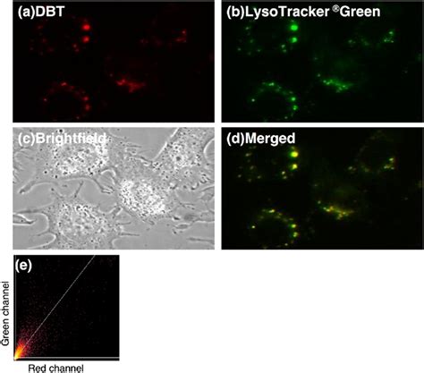 Fluorescence Images Of HepG2 Cells Loaded DBT And LysoTracker Green