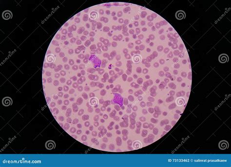 La Mancha De La Sangre Que Muestra Debajo Del Microscopio WBC Es ...