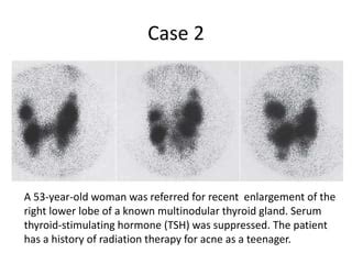 Nuclear Medicine - Thyroid, Parathyroid - Cases & Questions | PPT